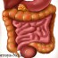 Основные симптомы дисбактериоза кишечника