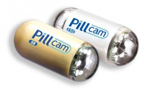 PillCam Colon – преимущества капсульного эндоскопа