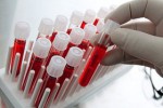 Может ли геморрой быть причиной повышенных лейкоцитов крови